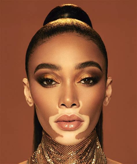 winnie harlow nude|Model Winnie Harlow Proudly Shows Her Vitiligo in a New Nude Selfie 